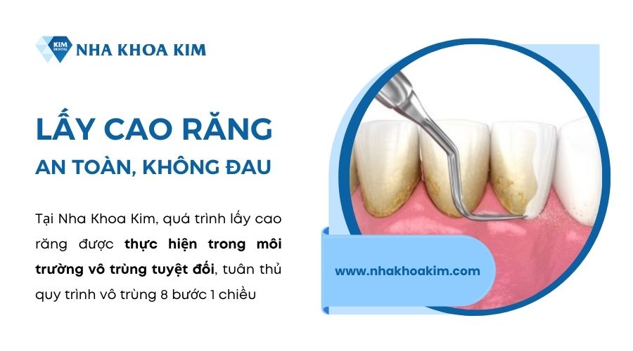 Cách khắc phục bựa răng