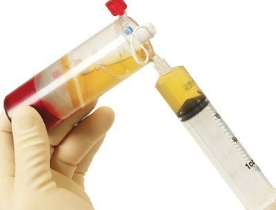 Huyết tương và huyết thanh đều là các thành phần của máu