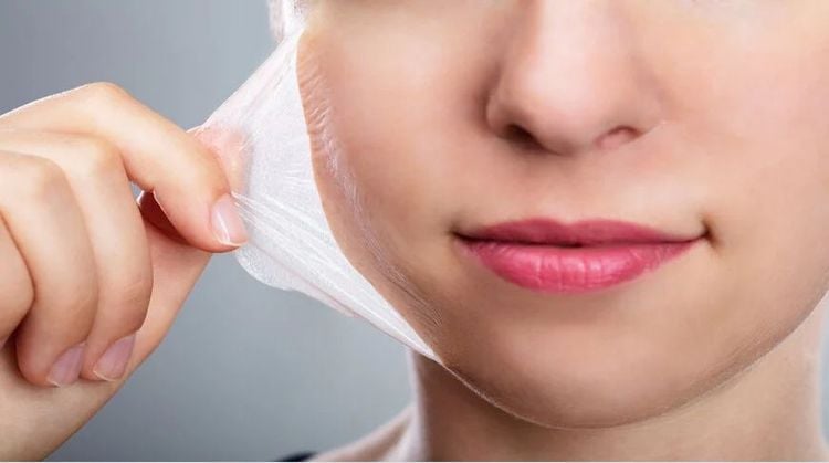 Peel da trên cơ bản có ba cấp độ bao gồm: Peel da nông, trung bình và sâu