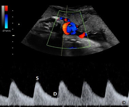 chuyen de gioi han 1