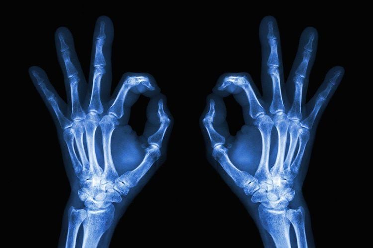 Tia X là một dạng bức xạ năng lượng cao không thể nhìn thấy được bằng mắt thường