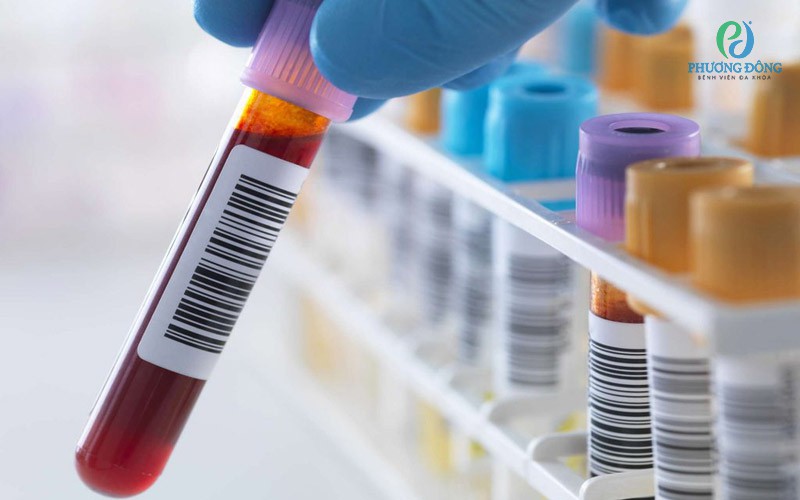 Chỉ số GRAN trong máu đo lường số lượng bạch cầu hạt bao gồm các loại bạch cầu như neutrophils, eosinophils và basophils