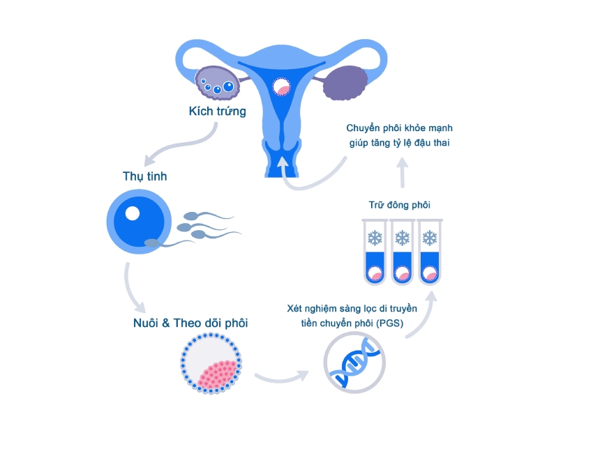 Sàng lọc IVF là một phần của quá trình thụ tinh trong ống nghiệm