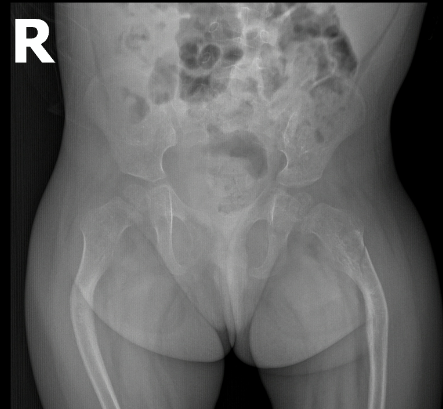 tinh chat cua tia x 1