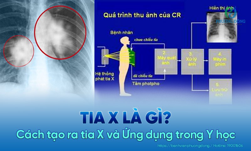 cách tạo ra tia x