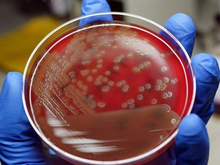 Mỗi loại vi khuẩn có tốc độ sản sinh khác nhau