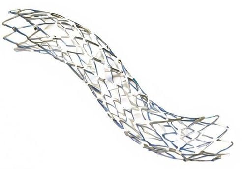 Đặt stent là một thủ thuật ít xâm lấn và có thời gian phục hồi nhanh hơn so với phẫu thuật bắc cầu mạch vành
