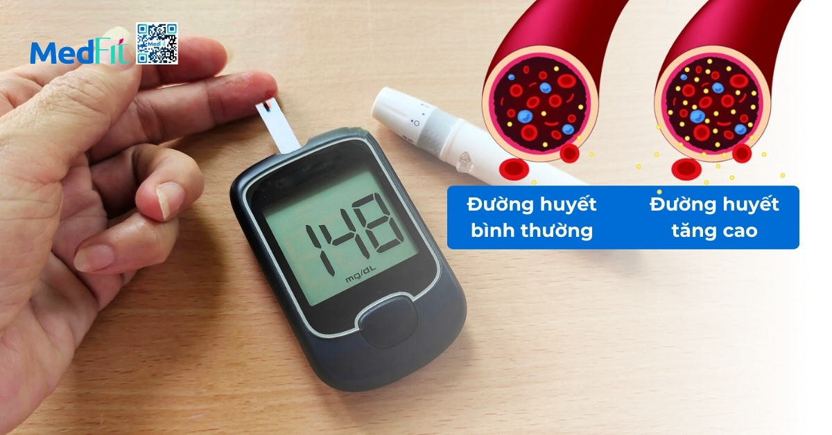 maltose có chỉ số đường huyết cao nên có thể làm tăng nhanh nồng độ đường trong máu