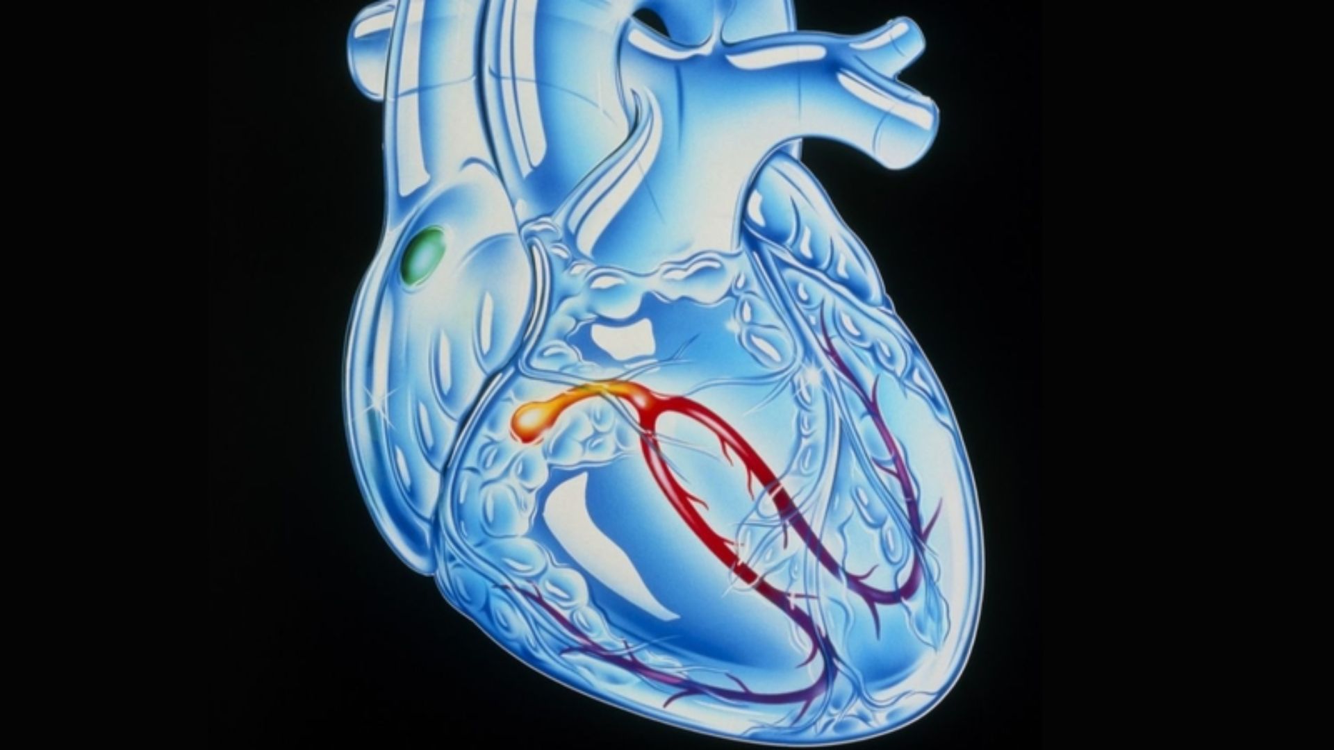 Hình ảnh minh họa hệ thống dẫn truyền tim