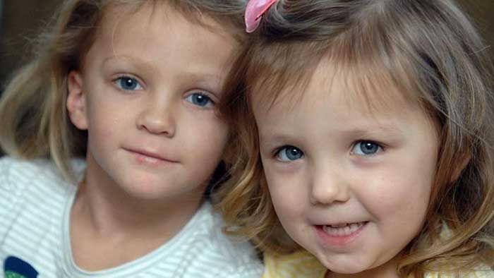 Hội chứng Turner là gì? Nguyên nhân, triệu chứng và biến chứng