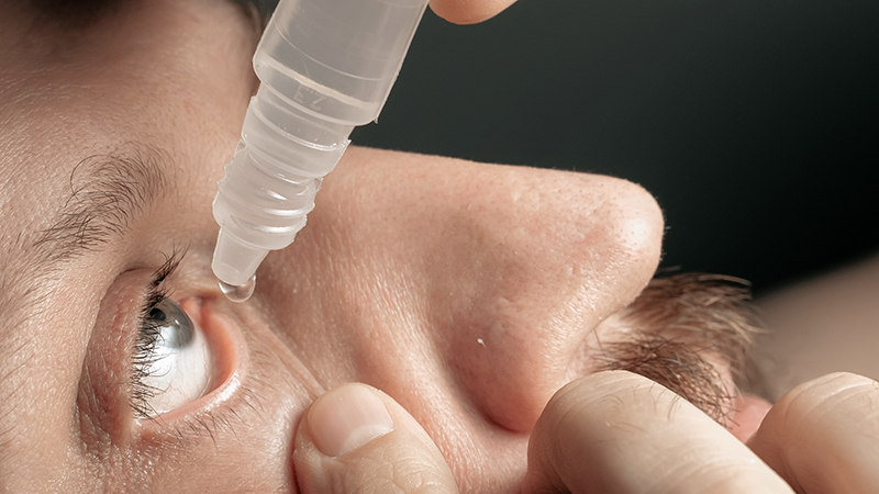 ต่อมไขมันที่เปลือกตาอุดตัน หนึ่งในตัวการโรคตาแห้ง