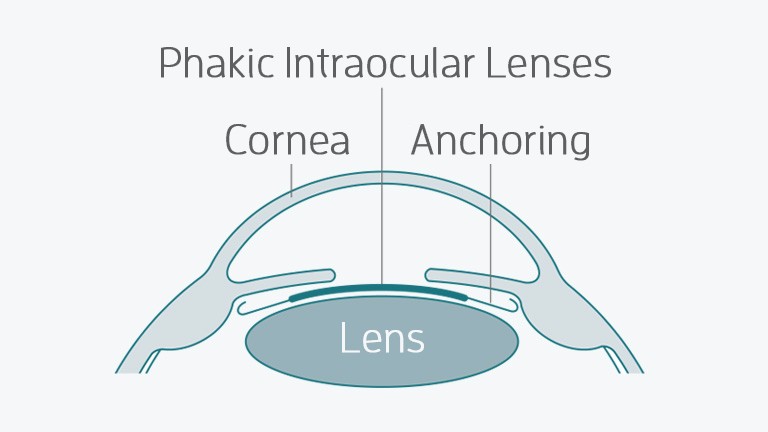 bo phan cua mat giong nhu thau kinh la 3