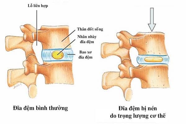 nhân nhầy có chức năng giảm xóc