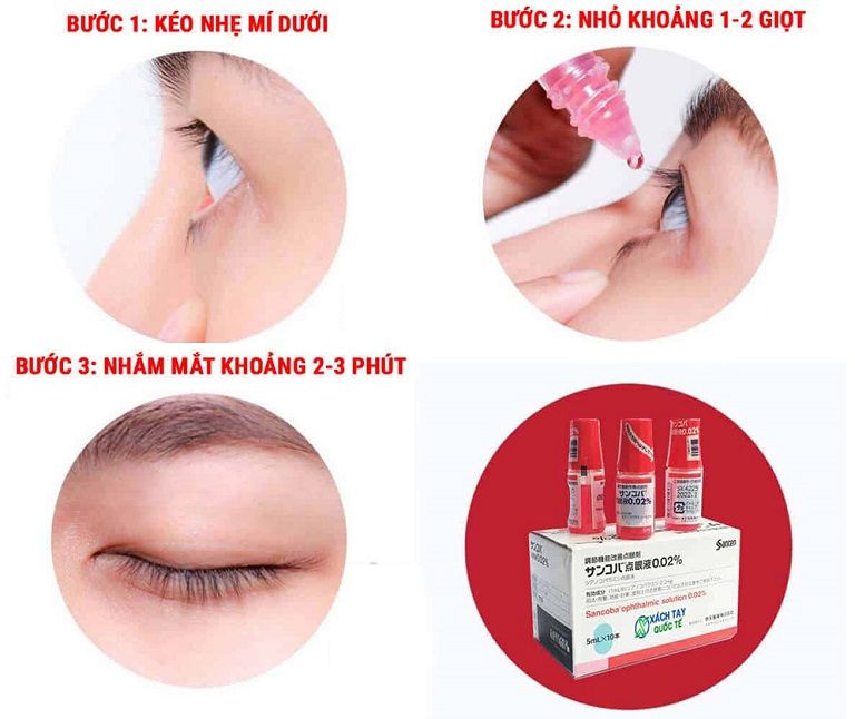 Hướng dẫn sử dụng thuốc nhỏ mắt Sancoba