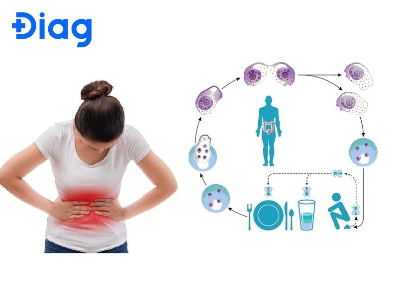 Trùng kiết lị lây truyền qua nước và thực phẩm bị nhiễm, gây bệnh về đường ruột.