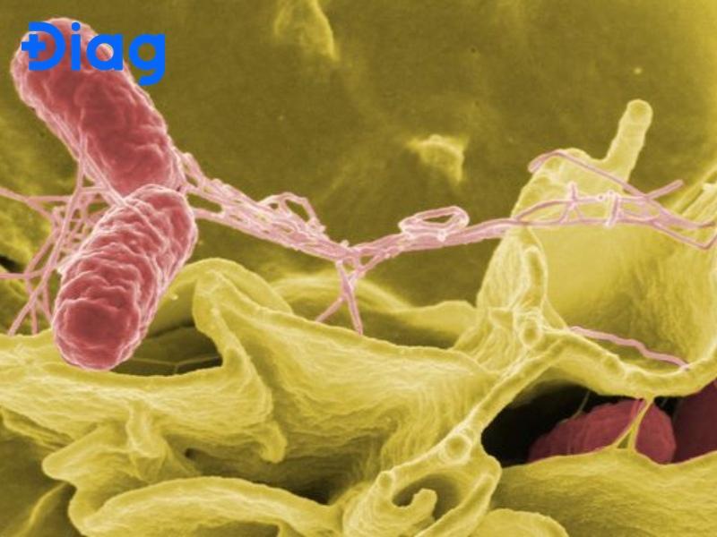 Trùng kiết lị là một loại ký sinh trùng đơn bào gây bệnh lỵ.