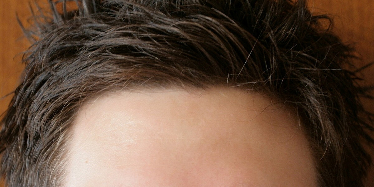 Con người có rất nhiều tướng trán nhưng trán thông minh sẽ có một số đặc điểm đặc trưng