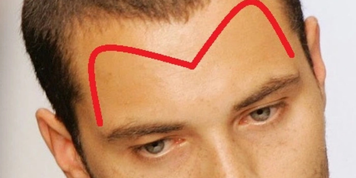 Chọn được từ đúng giữa cái trán hay cái chán, bạn sẽ biết người thông minh có tướng thế nào