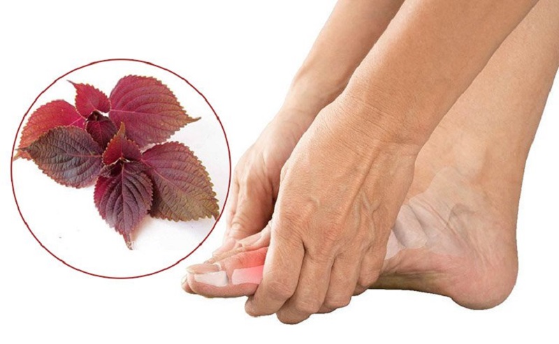 Lá tía tô có thể làm giảm enzym xanthin oxidase gây ra bệnh gout