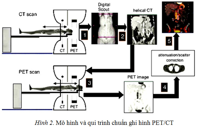 DCPX trong ghi hình PX PET