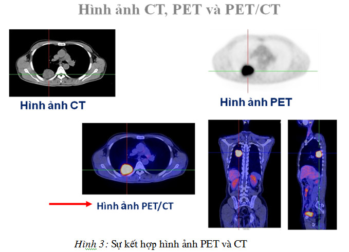 DCPX trong ghi hình PX PET