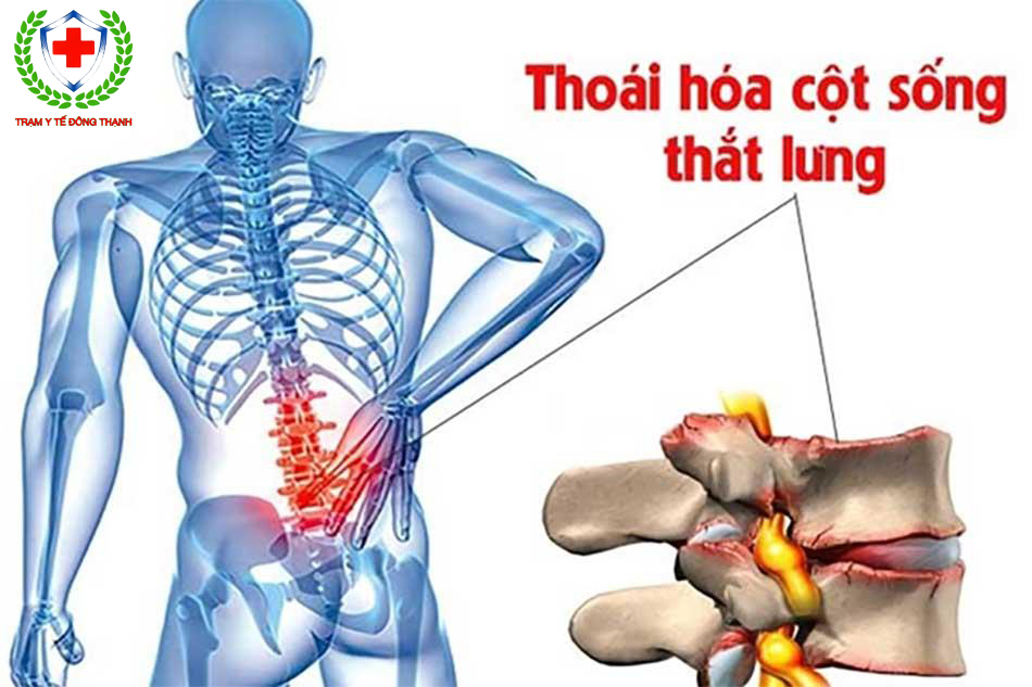 chat khoang chu yeu cau tao nen xuong nguoi la 7