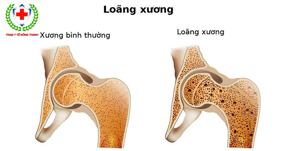 chat khoang chu yeu cau tao nen xuong nguoi la 9