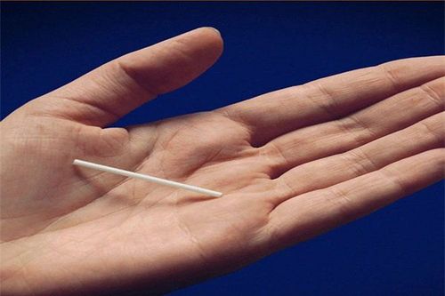 Phụ nữ có thể lấy que cấy bất cứ khi nào nếu muốn