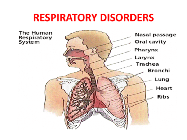 Nguyên nhân gây ra rối loạn hô hấp