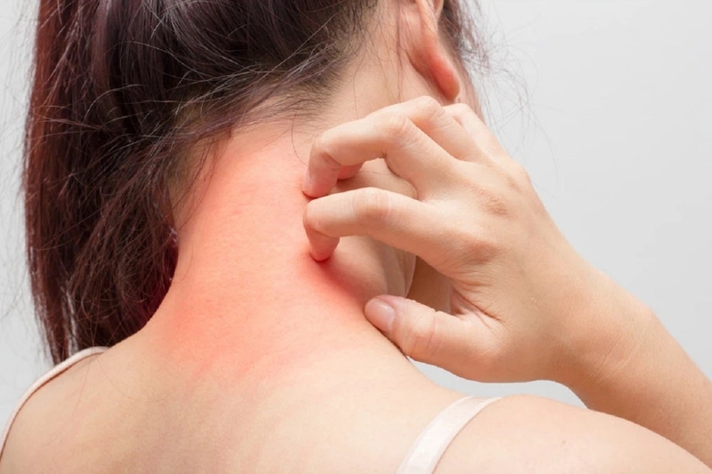 Mononatri glutamat là gì? Tại sao lại bị say MSG? 4