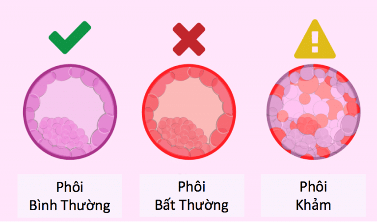 Phôi khảm là gì? Phôi khảm có chuyển được không? 1