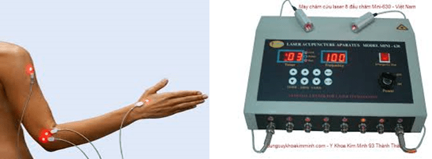 ứng dụng của laser trong y học