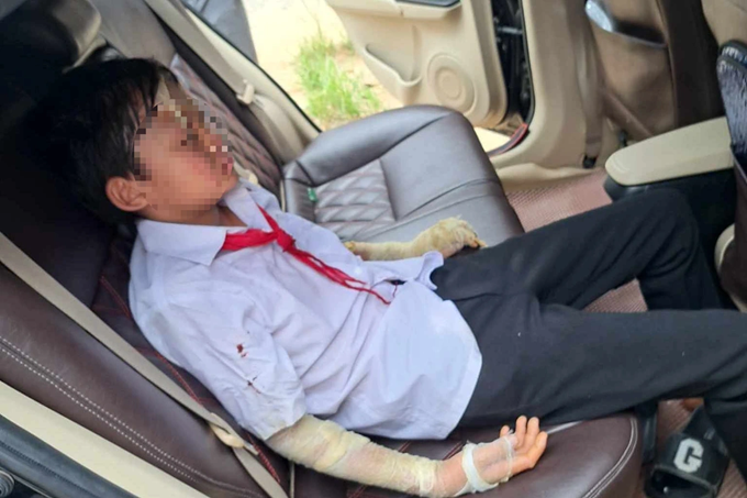 Vì sao bóng bay là món đồ chơi nguy hiểm chết người? - 2