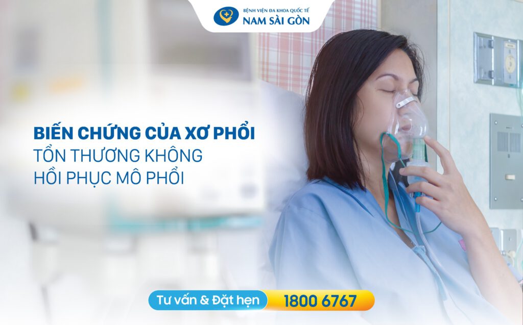 Biến chứng xơ hóa phổi nguy hiểm