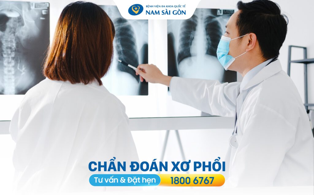Chẩn đoán xơ phổi