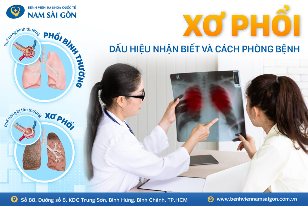 xơ phổi là gì