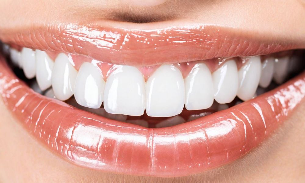 Vi khuẩn HP có thể tồn tại ở mảng bám gần chân răng.